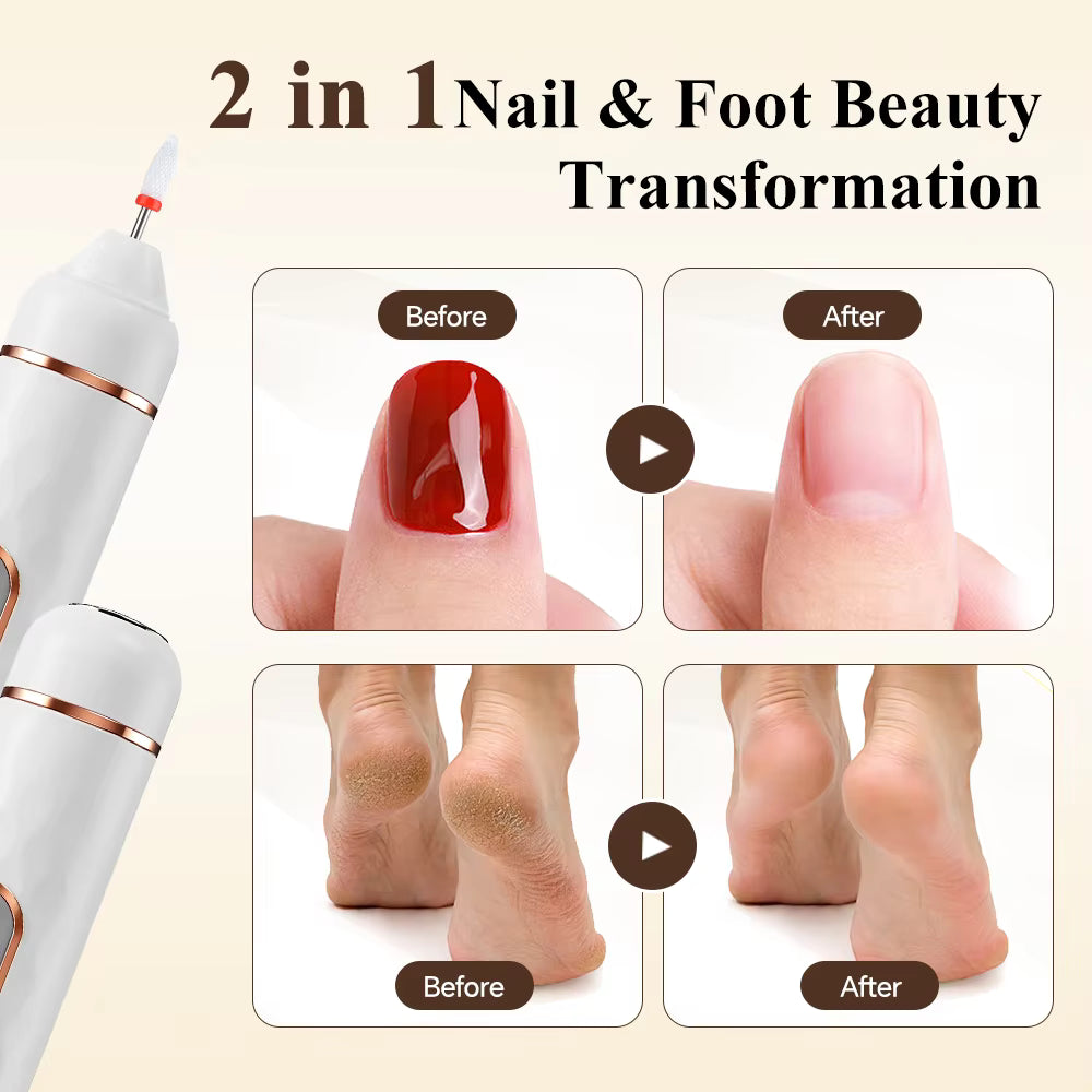 5-in-1 Rechargeable Electric Foot Callus Remover & Nail Grinder Pedicure Set