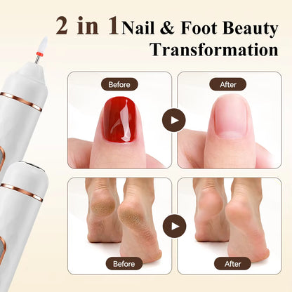 5-in-1 Rechargeable Electric Foot Callus Remover & Nail Grinder Pedicure Set